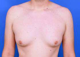 Patient Before & After Image