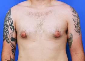 Patient Before & After Image