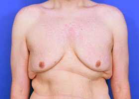 Patient Before & After Image