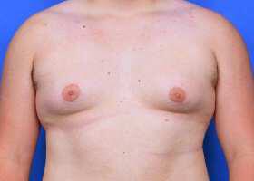 Patient Before & After Image