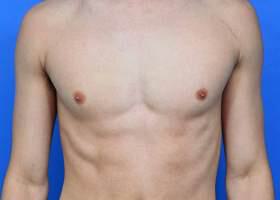 Patient Before & After Image