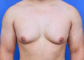 Patient Before & After Image