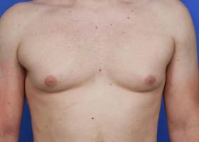 Patient Before & After Image