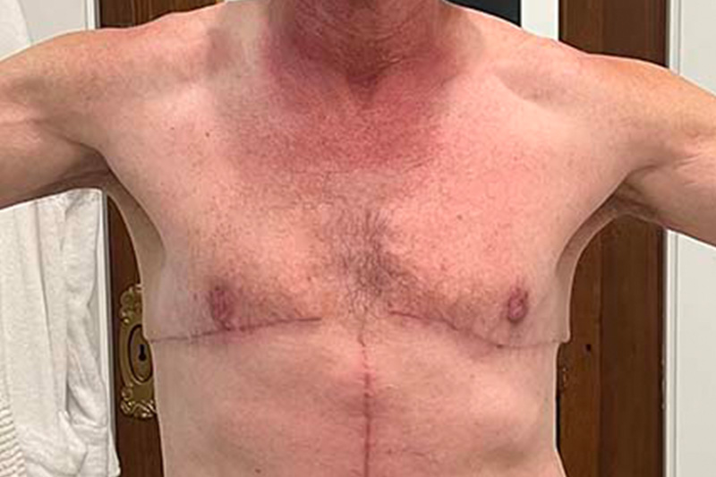 Patient Before & After Image