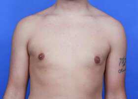 Patient Before & After Image