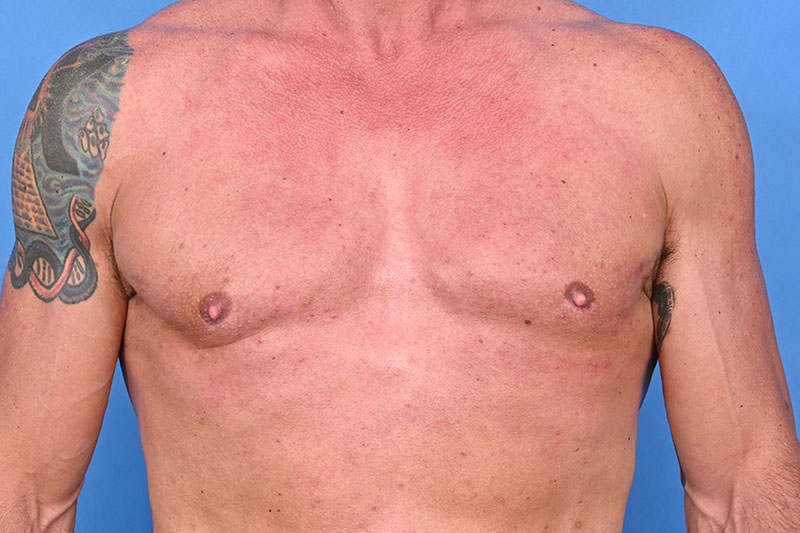 Patient Before & After Image