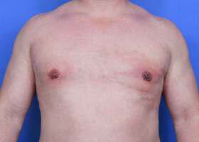 Patient Before & After Image