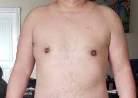 Patient Before & After Image