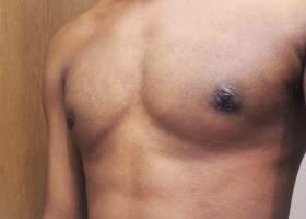 Patient Before & After Image