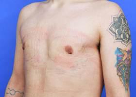 Patient Before & After Image