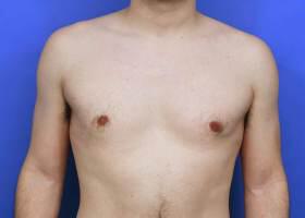 Patient Before & After Image