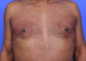 Patient Before & After Image