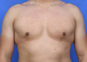 Patient Before & After Image