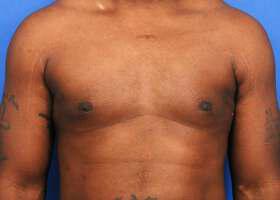 Patient Before & After Image