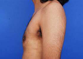 Patient Before & After Image