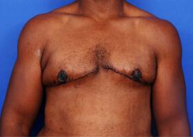 Patient Before & After Image