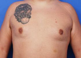 Patient Before & After Image