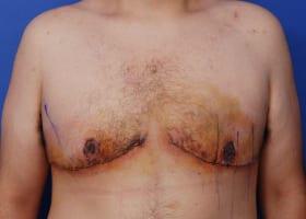 Patient Before & After Image