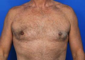 Patient Before & After Image