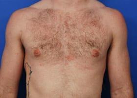 Patient Before & After Image