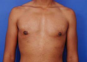 Patient Before & After Image