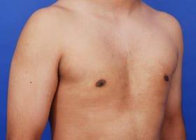 Patient Before & After Image