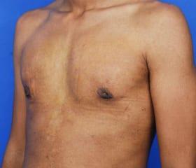 Patient Before & After Image