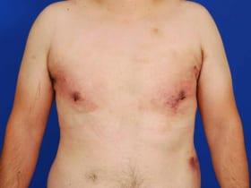 Patient Before & After Image