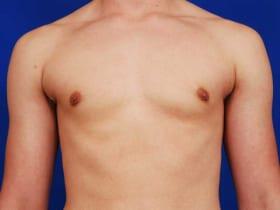 Patient Before & After Image