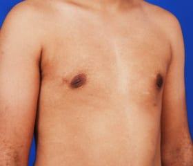 Patient Before & After Image