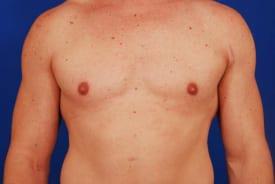 Patient Before & After Image