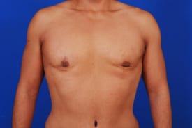 Patient Before & After Image