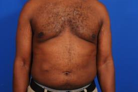 Patient Before & After Image