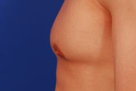 Patient Before & After Image