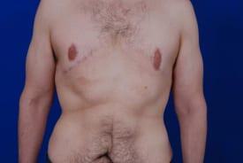 Patient Before & After Image