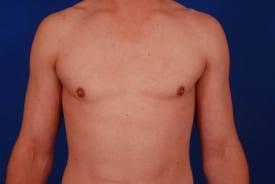 Patient Before & After Image