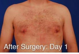 Patient Before & After Image