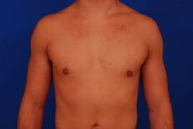 Patient Before & After Image