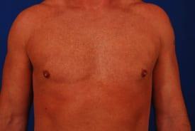 Patient Before & After Image