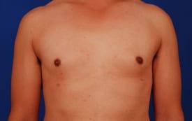 Patient Before & After Image