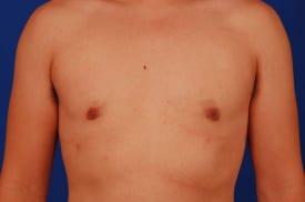 Patient Before & After Image