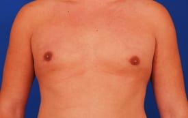 Patient Before & After Image