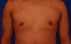 Patient Before & After Image