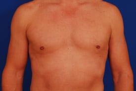 Patient Before & After Image