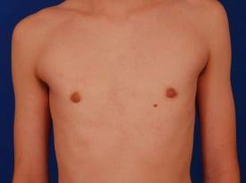 Patient Before & After Image