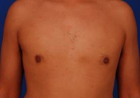 Patient Before & After Image