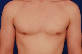 Patient Before & After Image