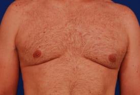 Patient Before & After Image