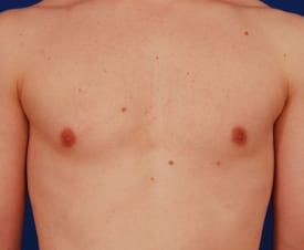 Patient Before & After Image