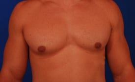 Patient Before & After Image